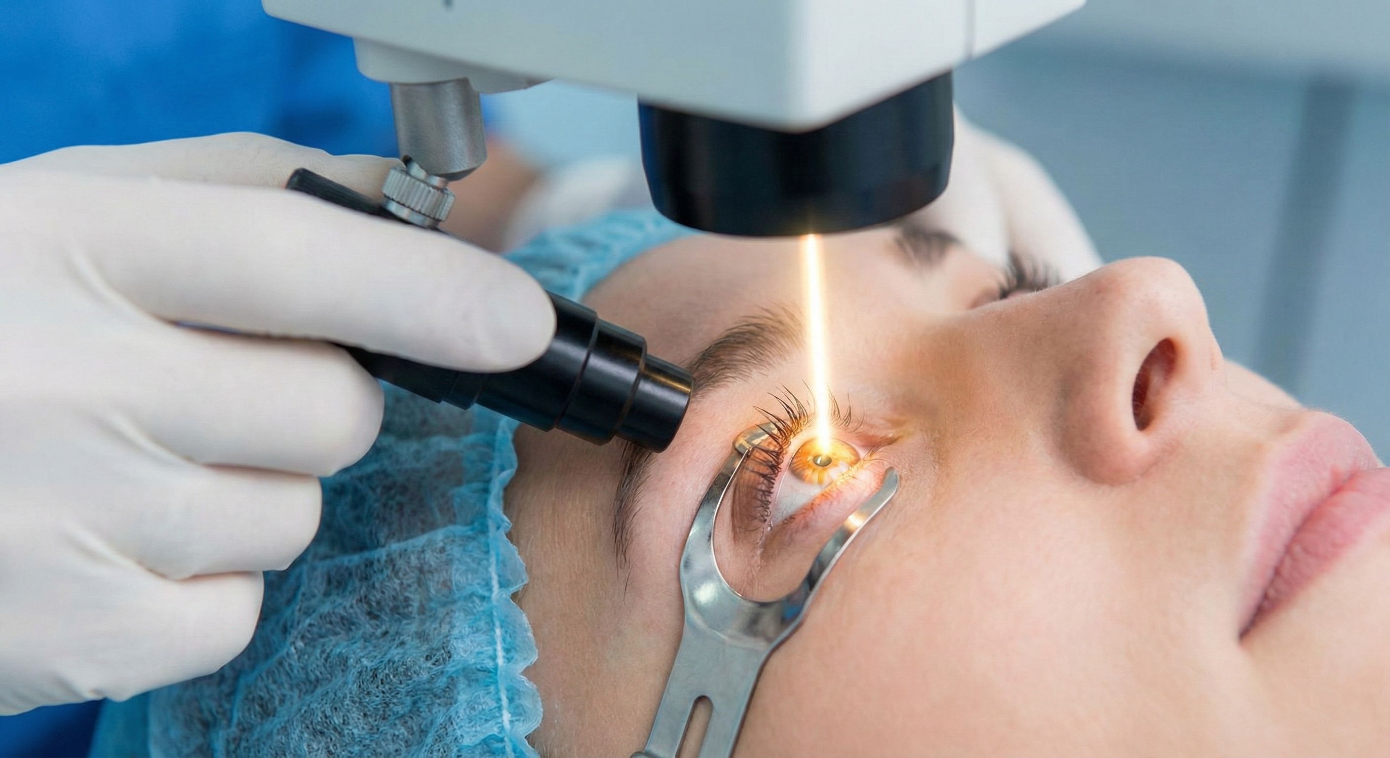 تصحيح الإبصار بالليزر